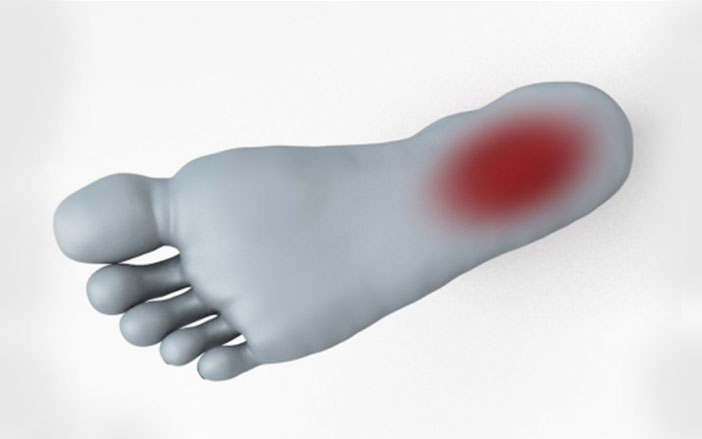 Plantar Fasciitis Jain hospital gurgaon ortho treatments