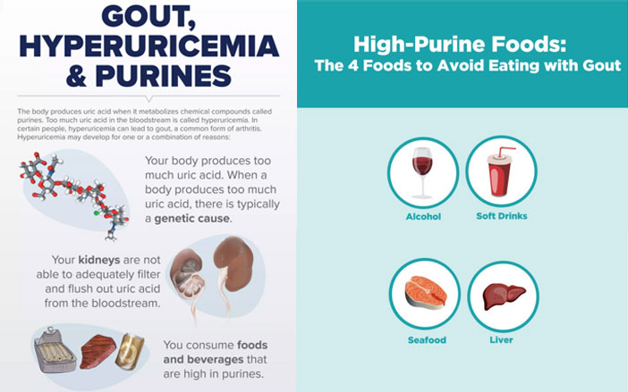 Uric Acid